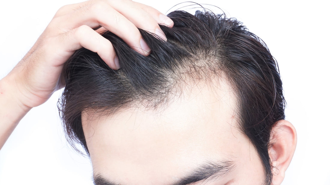 3 Ways to fight hair thinning