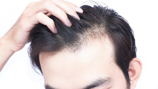 3 Ways to fight hair thinning